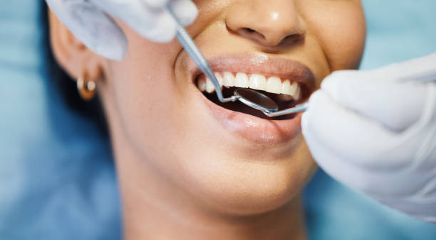 Teeth Whitening in AR